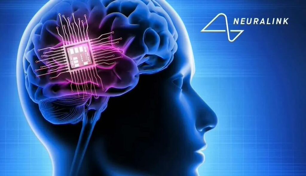 馬斯克Neuralink啟動腦機介面植入研究，計畫招募三名癱瘓患者