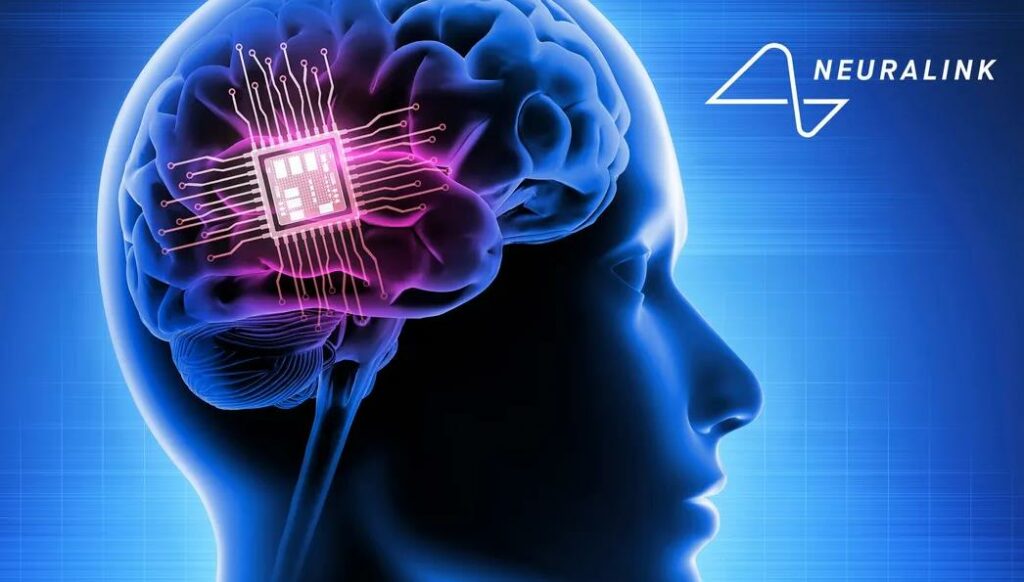 Neuralink估值飆升，員工欲透過回購計畫套現